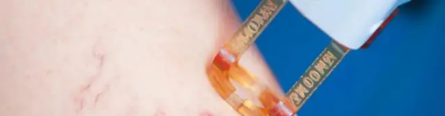 Быстрая обработка материала с помощью лазера