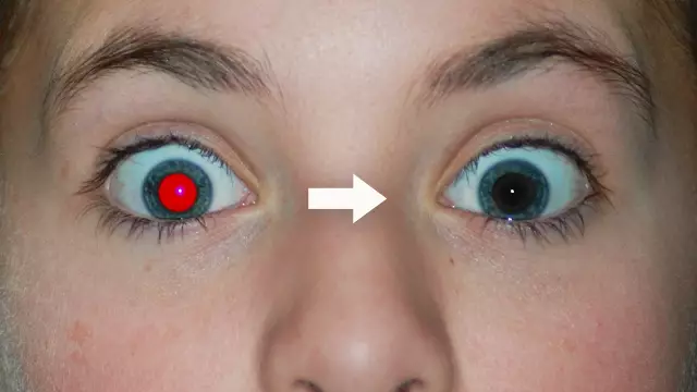 Как избавиться от красных глаз