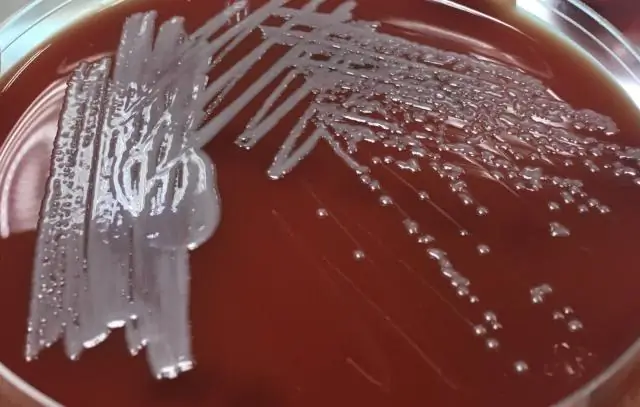 Микробиология: вопрос стоимости