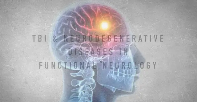 Нейродегенеративные заболевания: не все прионы