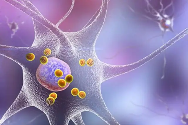 С собственными клетками против болезни Паркинсона