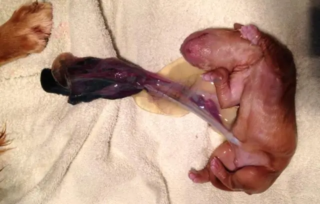 Стресс еще до рождения