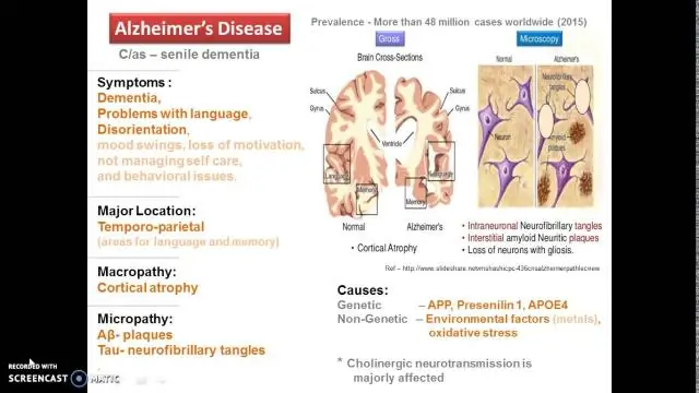 Нейродегенеративные заболевания: риск заражения