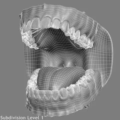 Топология мигрени