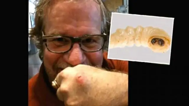 Инженеры разработали новый оптический микрозонд для обнаружения аномалий подповерхностных органов