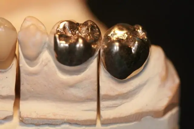 Изучается возможность использования керамических материалов в качестве биоматериала